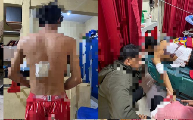 
					Polsek Cibungbulang Selidiki Dugaan Penganiayaan dengan Luka Bacok